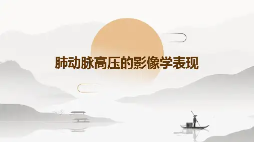肺动脉高压的影像学表现