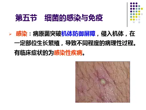 微生物免疫学:第五节 细菌的感染与免疫