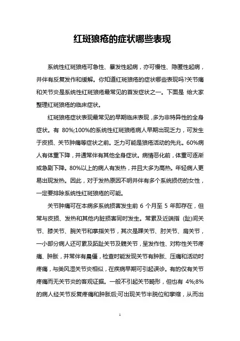 红斑狼疮的症状哪些表现