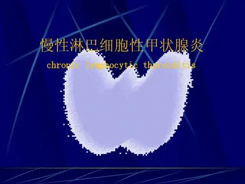 慢性甲状腺炎