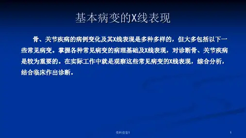 X线检查与诊断技术脊柱和四肢骨关节基本病变的X线表现行业荟萃
