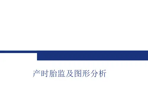 产时胎监图形分析1
