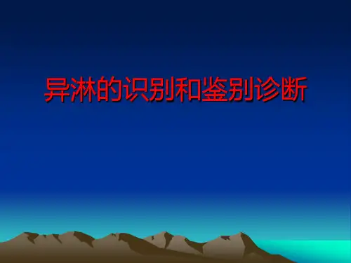 异淋的识别与鉴别诊断