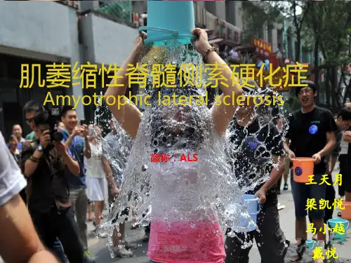 肌萎缩性脊髓侧索硬化症(医学知识)