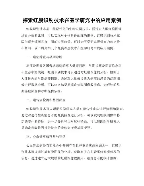 探索虹膜识别技术在医学研究中的应用案例
