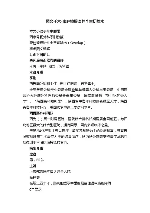 图文手术-腹腔镜根治性全胃切除术