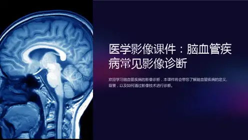 《医学影像课件：脑血管疾病常见影像诊断》