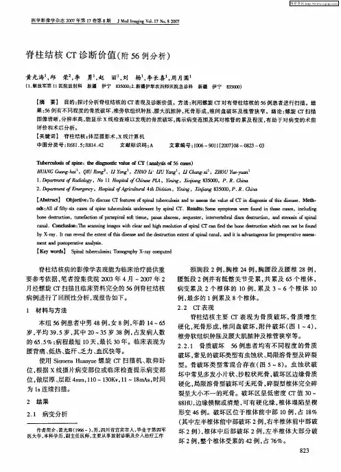 脊柱结核CT诊断价值(附56例分析)