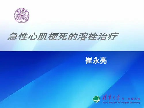 急性心肌梗死的溶栓治疗