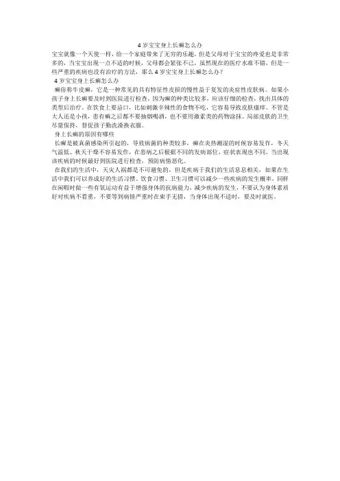 4岁宝宝身上长癣怎么办