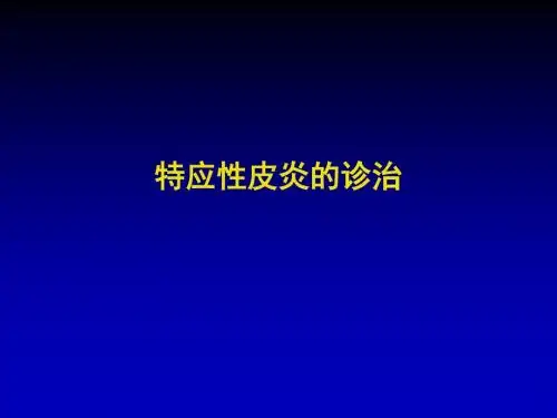 特应性皮炎的诊治PPT课件