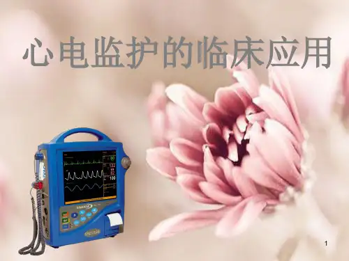 心电监护仪的应用PPT演示课件