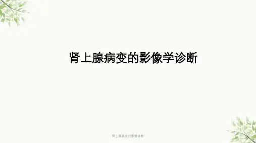 肾上腺病变的影像诊断课件