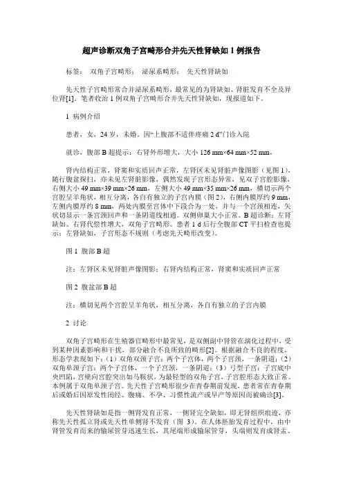 超声诊断双角子宫畸形合并先天性肾缺如1例报告