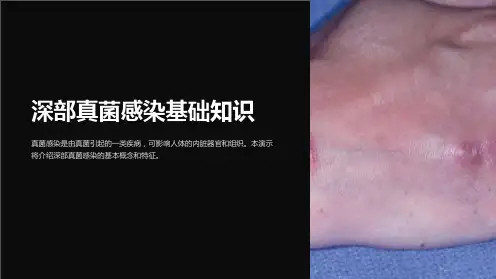 深部真菌感染基础知识