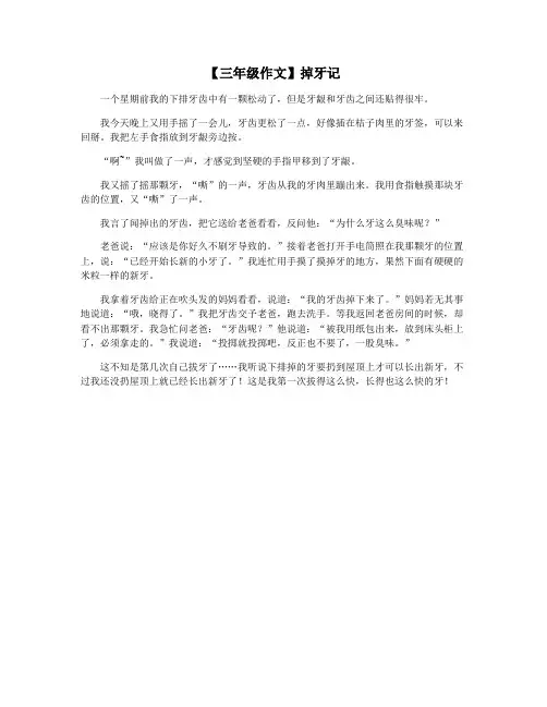 【三年级作文】掉牙记