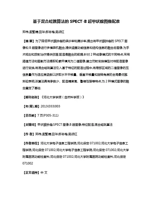 基于混合蛙跳算法的SPECT-B超甲状腺图像配准