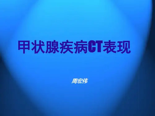 甲状腺疾病CT表现