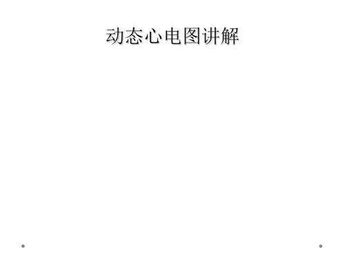 动态心电图讲解