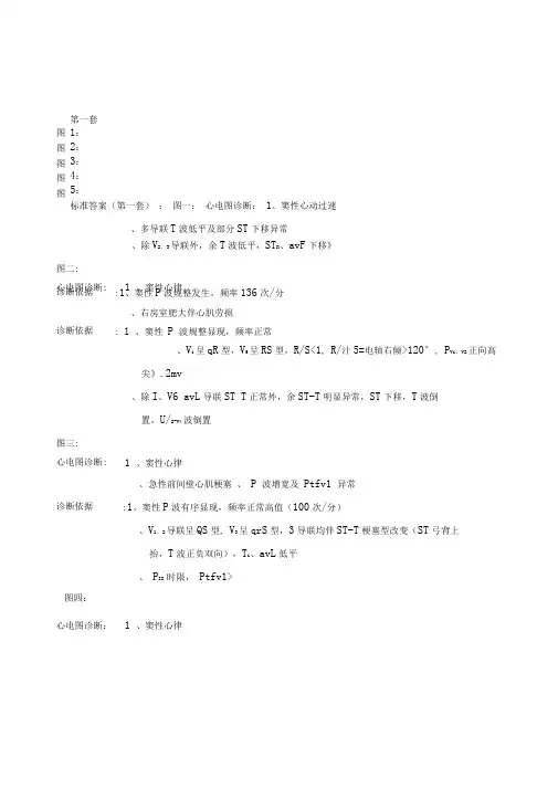 心电图试题及标准答案
