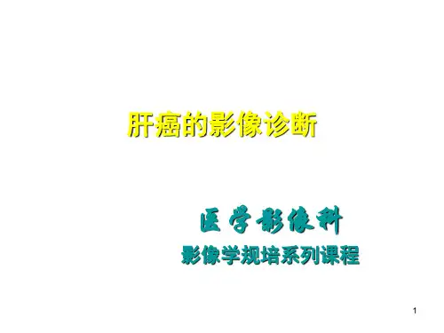 肝癌影像学表现ppt课件