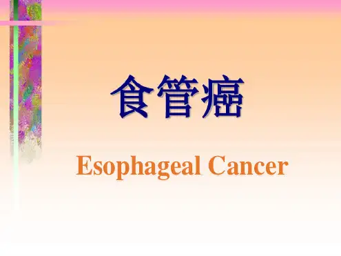 【2019年整理】食管癌