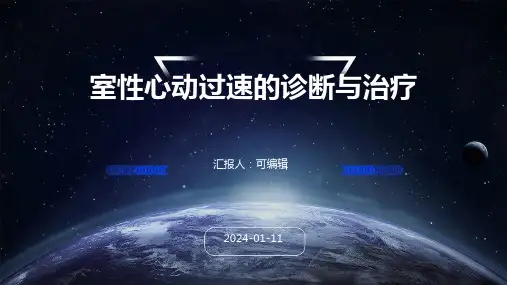 室性心动过速的诊断与治疗