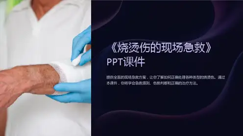 《烧烫伤的现场急救》课件