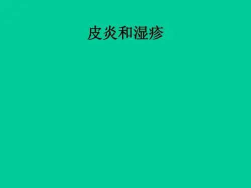 皮炎湿疹治疗