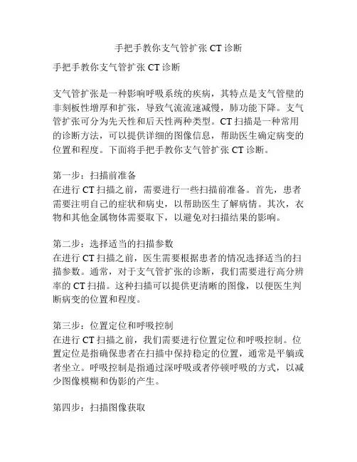 手把手教你支气管扩张CT诊断