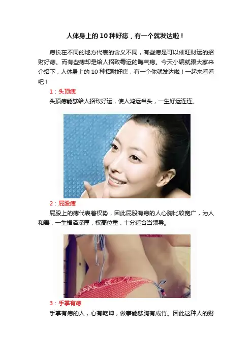 人体身上的10种好痣，有一个就发达啦！