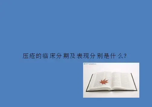 基础护理学课件第七章休息与活动