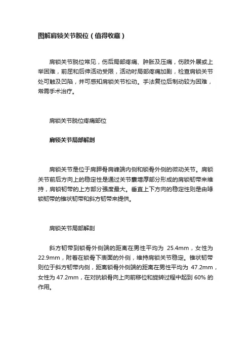 图解肩锁关节脱位（值得收藏）