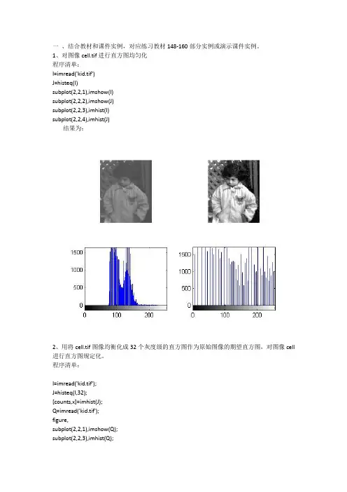 MATLAB实现数字图像增强_2