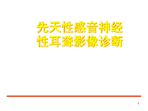 感音神经性耳聋影像诊断PPT幻灯片