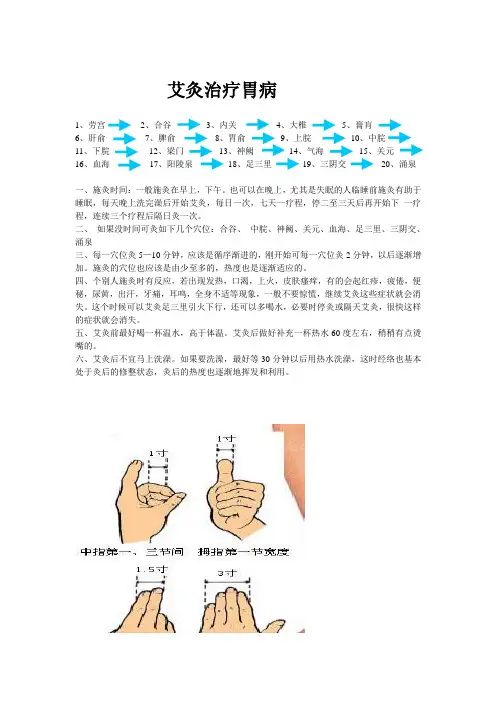 艾灸治疗胃病