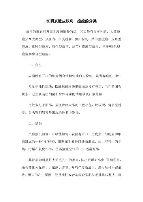 江阴京澄皮肤病—痘痘的分类