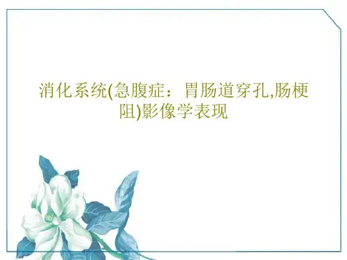 消化系统(急腹症：胃肠道穿孔,肠梗阻)影像学表现71页PPT
