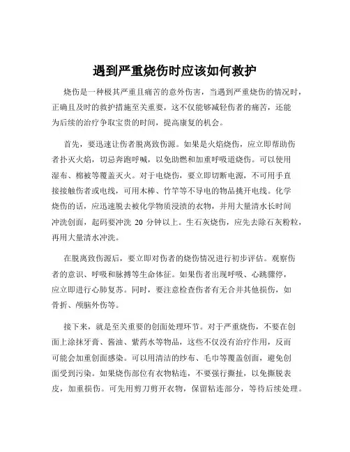 遇到严重烧伤时应该如何救护
