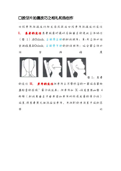 口腔牙片拍摄技巧