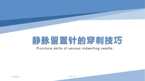 静脉留置针的穿刺技巧