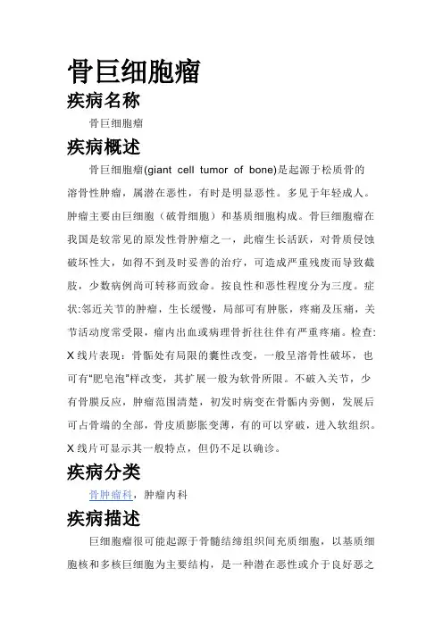 骨巨细胞瘤
