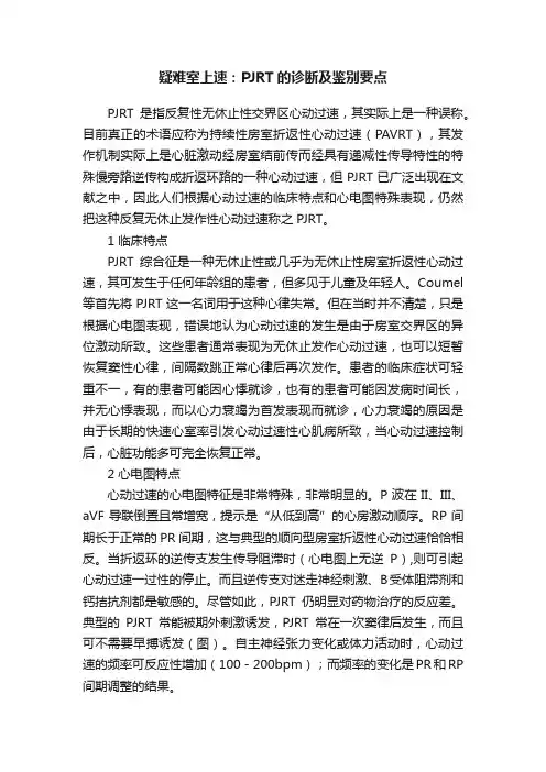 疑难室上速：PJRT的诊断及鉴别要点