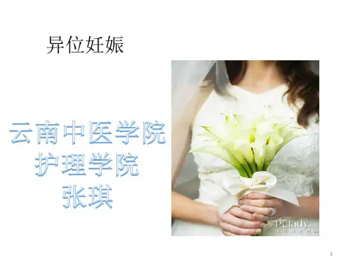 异位妊娠小讲课PPT课件