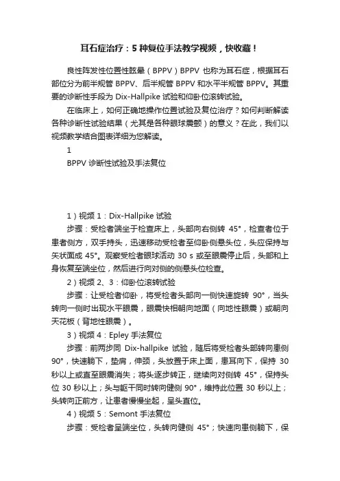 耳石症治疗：5种复位手法教学视频，快收藏！