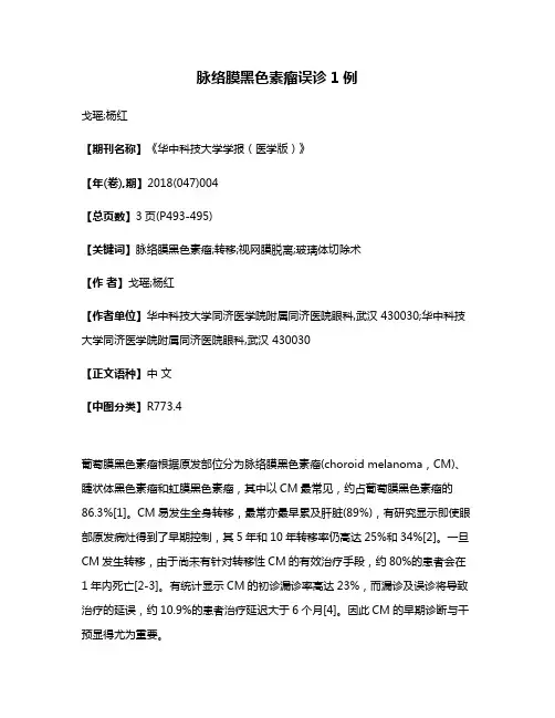 脉络膜黑色素瘤误诊1例