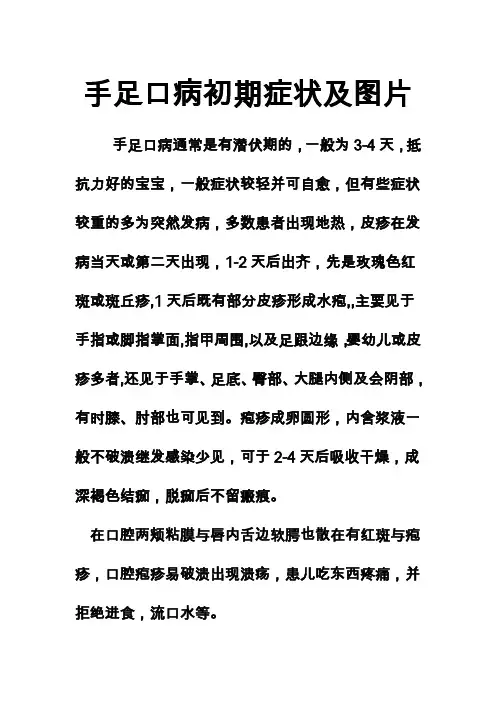 手足口病初期症状及图片