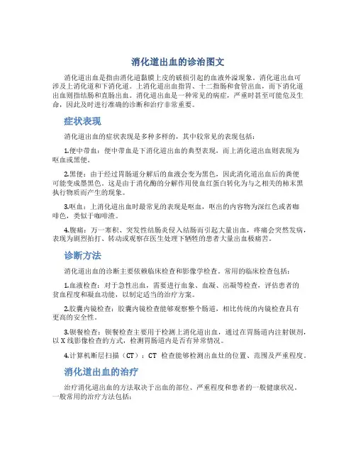 消化道出血的诊治图文