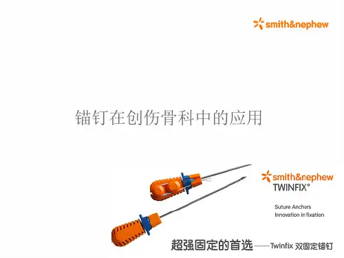 锚钉在创伤骨科中的应用PPT课件