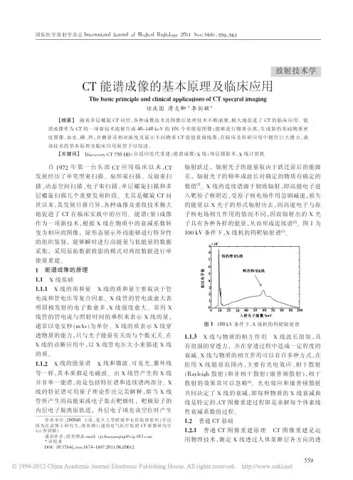 CT能谱成像的基本原理及临床应用